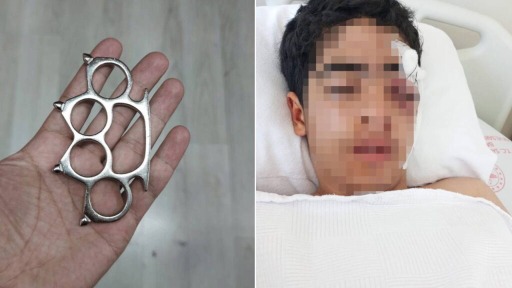 bu-kez-adres-istanbul-esenyurt-15-yasindaki-cocuga-akranindan-mustali-saldiri-vucudunda-cok-sayida-NPtzbKfs